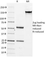 CD14 Antibody in SDS-PAGE (SDS-PAGE)