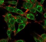 MED21/SRB7 Antibody in Immunocytochemistry (ICC/IF)