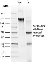 MED21/SRB7 Antibody in SDS-PAGE (SDS-PAGE)