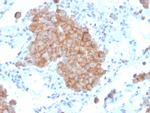 CD86 (Dendritic Cells Maturation Marker) Antibody in Immunohistochemistry (Paraffin) (IHC (P))