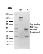 CD86 Antibody in SDS-PAGE (SDS-PAGE)