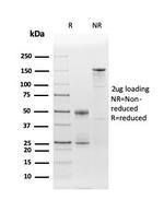 CD86 (Dendritic Cells Maturation Marker) Antibody in SDS-PAGE (SDS-PAGE)