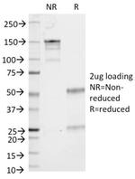 CD86 (Dendritic Cells Maturation Marker) Antibody in SDS-PAGE (SDS-PAGE)