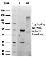 CD86 (Dendritic Cells Maturation Marker) Antibody in SDS-PAGE (SDS-PAGE)