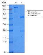 CD86 Antibody in SDS-PAGE (SDS-PAGE)