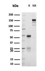 CD30/ TNFRSF8 (Hodgkin andReed-Sternberg Cell Marker) Antibody in SDS-PAGE (SDS-PAGE)