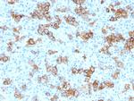 CD30/TNFRSF8 (Hodgkin and Reed-Sternberg Cell Marker) Antibody in Immunohistochemistry (Paraffin) (IHC (P))