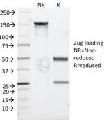 CD30/TNFRSF8 (Hodgkin and Reed-Sternberg Cell Marker) Antibody in SDS-PAGE (SDS-PAGE)