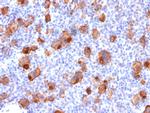 CD30/TNFRSF8 Antibody in Immunohistochemistry (Paraffin) (IHC (P))