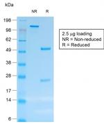 CD30/TNFRSF8 (Hodgkin and Reed-Sternberg Cell Marker) Antibody in SDS-PAGE (SDS-PAGE)