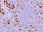 CD30/TNFRSF8 Antibody in Immunohistochemistry (Paraffin) (IHC (P))