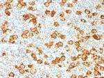 CD30/TNFRSF8 Antibody in Immunohistochemistry (Paraffin) (IHC (P))