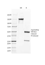 CD34 (Hematopoietic Stem Cell and Endothelial Marker) Antibody in SDS-PAGE (SDS-PAGE)