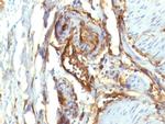 CD34 (Hematopoietic Stem Cell and Endothelial Marker) Antibody in Immunohistochemistry (Paraffin) (IHC (P))