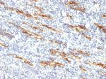 CD34 (Hematopoietic Stem Cell and Endothelial Marker) Antibody in Immunohistochemistry (Paraffin) (IHC (P))