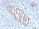 ATG5 Antibody in Immunohistochemistry (Paraffin) (IHC (P))