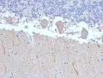 ATG5 Antibody in Immunohistochemistry (Paraffin) (IHC (P))