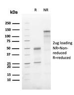 ATG5 Antibody in SDS-PAGE (SDS-PAGE)