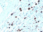 Napsin A (Lung Adenocarcinoma Marker) Antibody in Immunohistochemistry (Paraffin) (IHC (P))