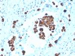 Napsin A (Lung Adenocarcinoma Marker) Antibody in Immunohistochemistry (Paraffin) (IHC (P))