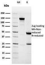 Napsin A (Lung Adenocarcinoma Marker) Antibody in SDS-PAGE (SDS-PAGE)