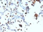 Napsin A Antibody in Immunohistochemistry (Paraffin) (IHC (P))