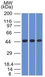 Napsin A (Lung Adenocarcinoma Marker) Antibody in Western Blot (WB)