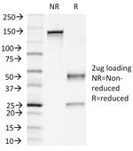 Napsin A (Lung Adenocarcinoma Marker) Antibody in SDS-PAGE (SDS-PAGE)