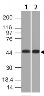 Napsin A (Lung Adenocarcinoma Marker) Antibody in Western Blot (WB)