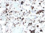 Napsin A Antibody in Immunohistochemistry (Paraffin) (IHC (P))