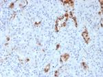 Napsin A (Lung Adenocarcinoma Marker) Antibody in Immunohistochemistry (Paraffin) (IHC (P))