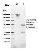 Napsin A (Lung Adenocarcinoma Marker) Antibody in SDS-PAGE (SDS-PAGE)