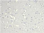 CD38 (ADP Ribosyl Cyclase I) Antibody in Immunohistochemistry (Paraffin) (IHC (P))