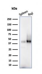 CD38 (ADP Ribosyl Cyclase I) Antibody in Western Blot (WB)