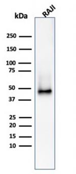 CD38 (ADP Ribosyl Cyclase I) Antibody in Western Blot (WB)