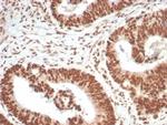 WTAP Antibody in Immunohistochemistry (Paraffin) (IHC (P))