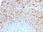 CD40 Ligand/CD154/TRAP1 (Activation Marker of T-Lymphocytes) Antibody in Immunohistochemistry (Paraffin) (IHC (P))