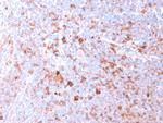 CD40 Ligand/CD154/TRAP1 (Activation Marker of T-Lymphocytes) Antibody in Immunohistochemistry (Paraffin) (IHC (P))