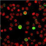 CD40 Ligand/CD154/TRAP1 (Activation Marker of T-Lymphocytes) Antibody in Immunocytochemistry (ICC/IF)