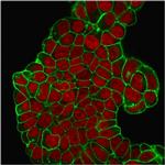 CD47/IAP (Integrin Associated Protein) Antibody in Immunocytochemistry (ICC/IF)