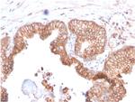 CD47/IAP (Integrin Associated Protein) Antibody in Immunohistochemistry (Paraffin) (IHC (P))