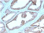 CD47/IAP (Integrin Associated Protein) Antibody in Immunohistochemistry (Paraffin) (IHC (P))