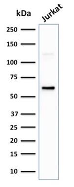 CD63 Antibody in Western Blot (WB)