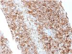 CD63 Antibody in Immunohistochemistry (Paraffin) (IHC (P))