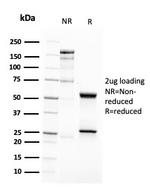 CD63 Antibody in SDS-PAGE (SDS-PAGE)