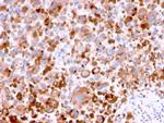 CD63 Antibody in Immunohistochemistry (Paraffin) (IHC (P))