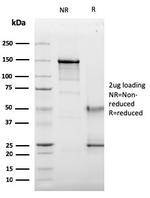 CD63 (Late Endosomes Marker) Antibody in SDS-PAGE (SDS-PAGE)