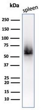 CD63 (Late Endosomes Marker) Antibody in Western Blot (WB)