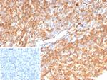 CD74 (B-Cell Marker) (Transcription Regulator) Antibody in Immunohistochemistry (Paraffin) (IHC (P))