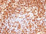 CD74 (B-Cell Marker) (Transcription Regulator) Antibody in Immunohistochemistry (Paraffin) (IHC (P))